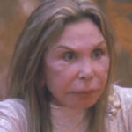 Elsa Patton’s face was “ruined” by a plastic surgeon, as evidenced by photos of the reality star’s former beauty.