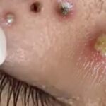 Dr. Sandra Lee Videos Part 79