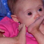 They advised the mother to give up her Down syndrome kid, but she refused to do so… Here is how she looks today as a model