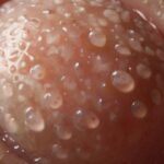 10 METHODS for Treating