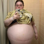 Doctors were astounded by what they saw when they examined her erupting belly as it continued to grow.